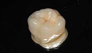 Corona dentale in zirconia-ceramica