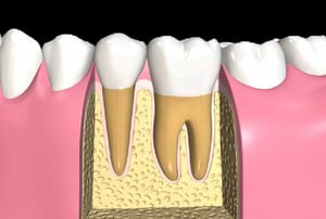 Sezione di due denti completamente sani senza carie o infezioni