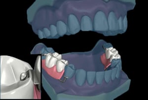 Modello digitale dell’arcata superiore e inferiore con denti naturali integri, senza protesi.
